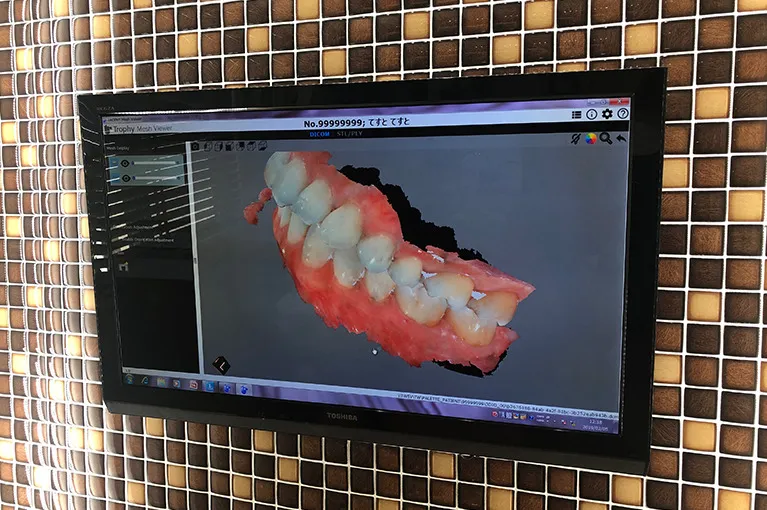 3Dスキャンとは？